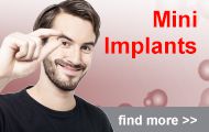 Mdi Implant Bannerini Home Mini Implants